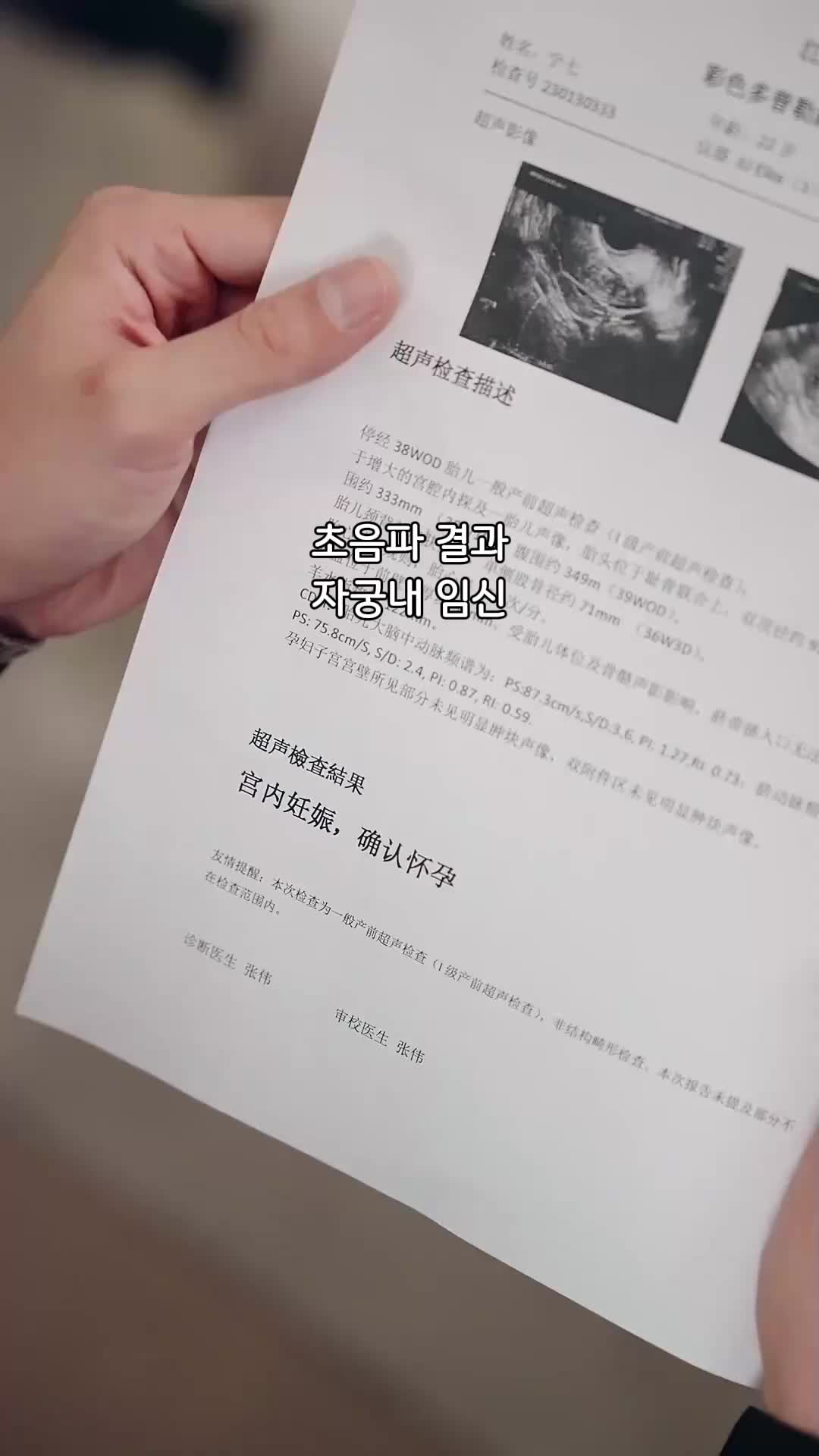 87회
