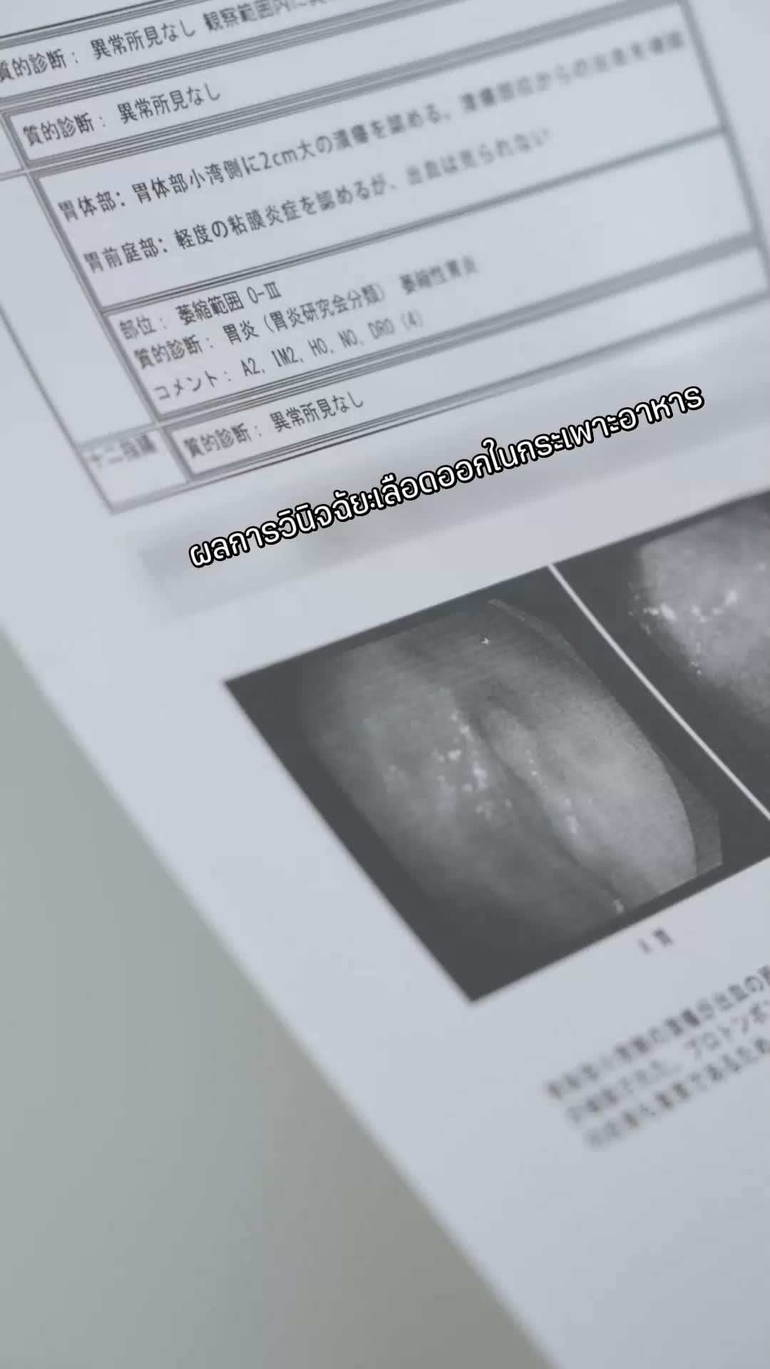 ตอนที่ 40