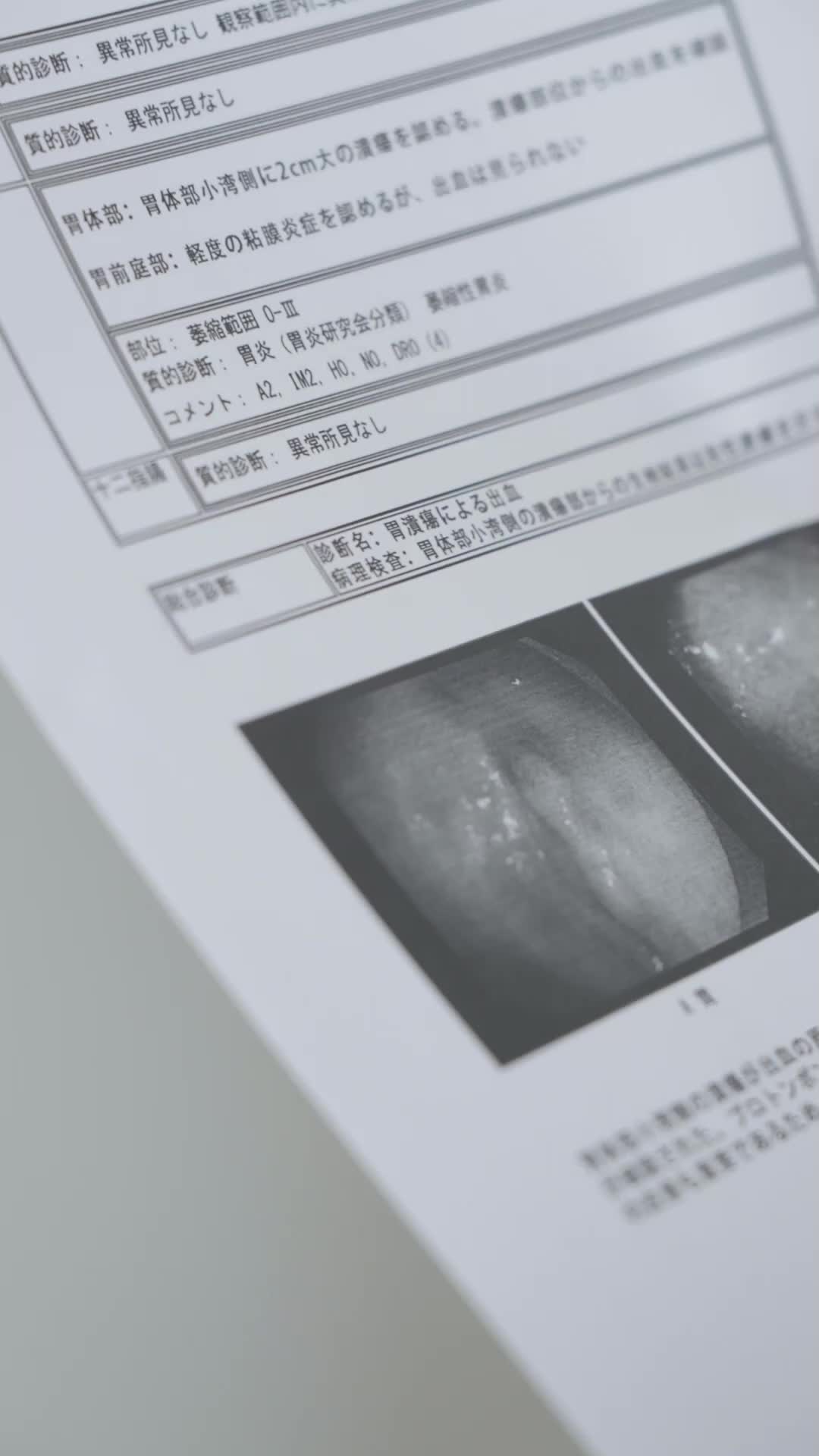 第40集